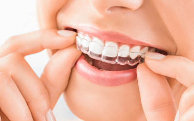 ¿Qué es una férula de descarga?