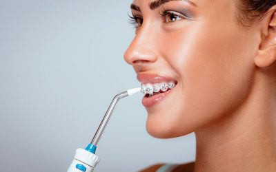 Irrigador Dental: Cómo se usa y mantiene.